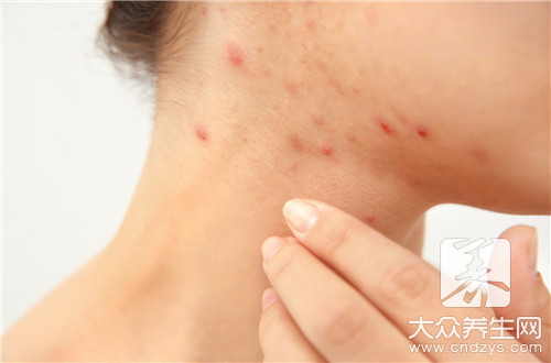 �촯��ʲôҩ�����