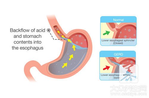 θ����֢״��ʲôҩ�ã�